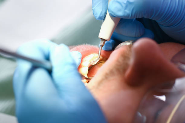 Best Emergency Care for Gum Disease in Goodland, KS