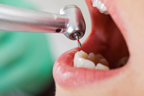 Best Emergency Cosmetic Dentistry (e.g., broken veneers) in Goodland, KS